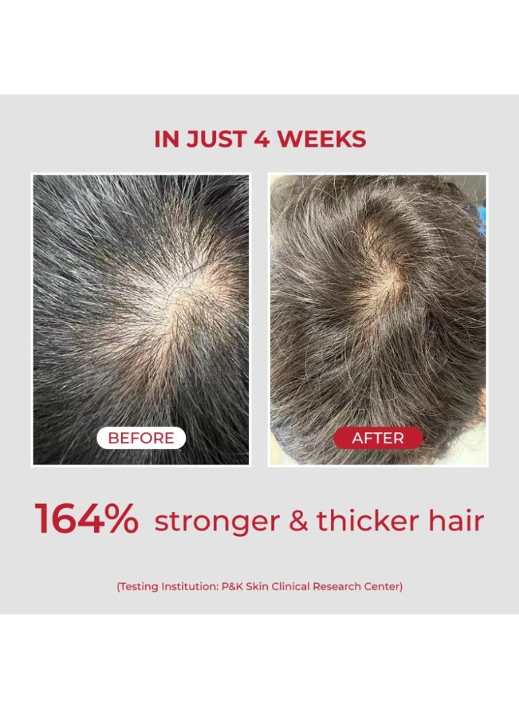 MOEV Hair Loss & Weak Roots Treatment – MOEV Annurcatin Anti-Hair Fall Shampoo & Hair Tonic Set for Stronger, Thicker Growth - Image 5